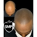 SMP INK Seattle - Hair Replacement