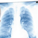 Nebraska Pulmonary Specialties - Physicians & Surgeons, Pulmonary Diseases