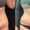 SR Plastic Surgery P.C.- Smita R. Ramanadham, M.D., F.A.C.S gallery