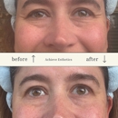Achieve Esthetics