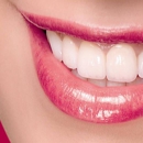 MINT orthodontics | Heights - Orthodontists