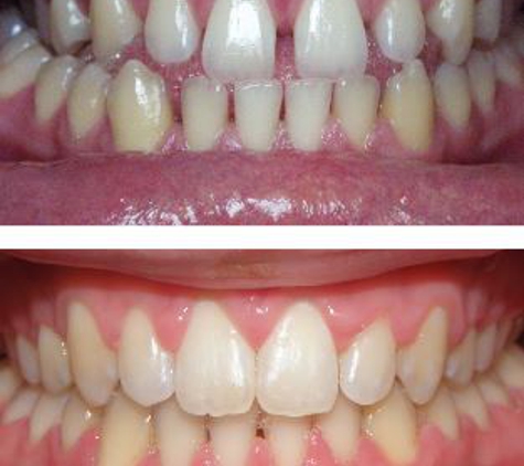 Glenn Carty Orthodontist - Gungahlin, ACT