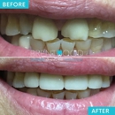 Brentwood Dental Arts - Dental Hygienists