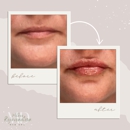 Wilkes Rejuvenation MD - Day Spas
