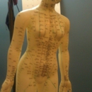 The Healing Center - Acupuncture
