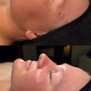 Ashley Skin Esthetics - Clinics