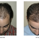 Liposuction and Cosmetic Surgery Institute - Surgery Centers