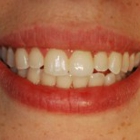 Prosthetic Dentistry of Washington DC