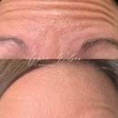 Wilson Aesthetics Beauty + Wellness - Day Spas
