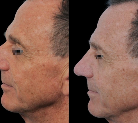 Facial Surgery Institute of Boca Raton - Boca Raton, FL