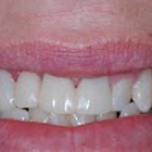 Love Dentistry - Dr. Sheri Boynton- Love