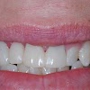 Love Dentistry - Dr. Sheri Boynton- Love
