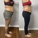 Serenity Sculpt and Post Care - Massage Services