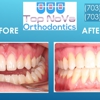 Top Nova Orthodontics gallery