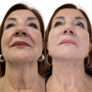 Dr. Busso Cosmetic Dermatologist - Botox, Laser, Fillers, PRP, Semaglutide - Medical Spas