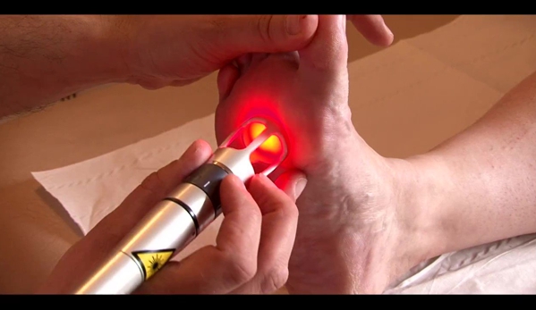 6S PHYSIO Mingara - Tumbi Umbi, NSW. K-Laser and Shockwave Treatments