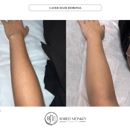 Bared Monkey Laser Spa - Long Island City - Skin Care