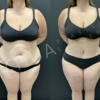 Chua Plastic Surgery gallery