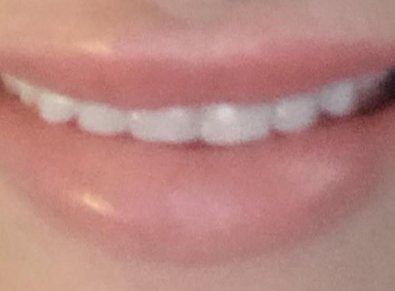 Sutherland Smile Denture Clinic - Sutherland, NSW. All smiles , thanks darling!