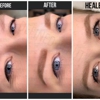 Defined Beauty Permanent Makeup gallery
