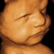 Picture Perfect 3D/4D Ultrasound Imaging