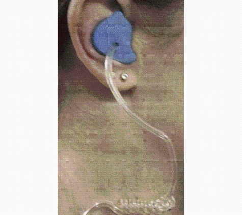 Earmold Sydney - Blacktown, NSW
