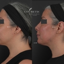 Cosmetic Injectables Center Medspa - Reducing & Weight Control