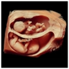 Peekaboo 3D 4D Ultrasound gallery