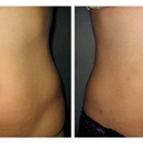 Jayasinghe Walter MD - Laser Surgery Center - Physicians & Surgeons, Gynecology