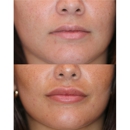 Destin Botox Laser and Facial Esthetics - Day Spas