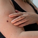 Advanced Dermatology & Skin Cancer Specialists Riverside - Skin Care