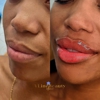 VLine Beauty Clinic gallery