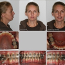 Limestone Hills Orthodontics - Austin, TX - Orthodontists