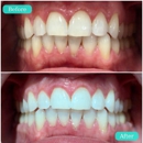 iSmile Spas - Dental Hygienists