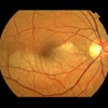 Mid Atlantic Retina gallery