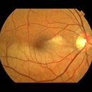 Mid Atlantic Retina - Physicians & Surgeons, Ophthalmology