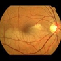 Mid Atlantic Retina