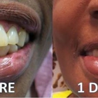 Advanced Oral Surgery of Tampa