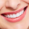 Smart Arches Dental Implants gallery