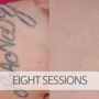 Eraditatt Tattoo Removal of Tampa