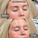 Liv Med Spa | Sioux Falls, SD - Day Spas