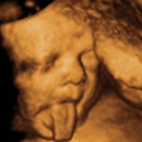 Baby's Bungalow 3D & 4D Ultrasound - Medical Imaging Services