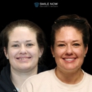 Smile Now Reno Dentures and Implants - Dentists