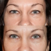 Vida Bela Plastic Surgery: Chelsea Snider MD gallery
