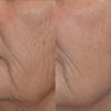 Laser Skin Solutions gallery