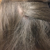 Lice Clinics of America - Little Rock gallery