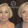 Texas Plastic Surgery Associates, PA gallery