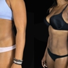 NOVA Plastic Surgery - Tysons Corner gallery
