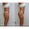 Toxwell Med Spa and Wellness gallery