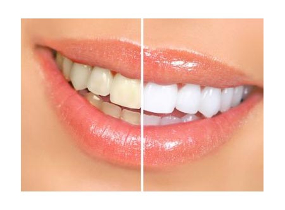 Dental Vision - Mirrabooka, WA